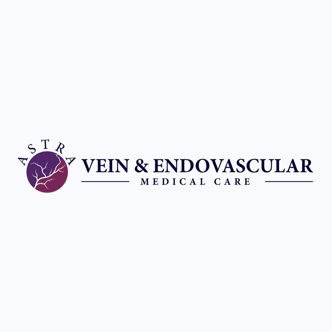 Astra Vein Treatment Center review